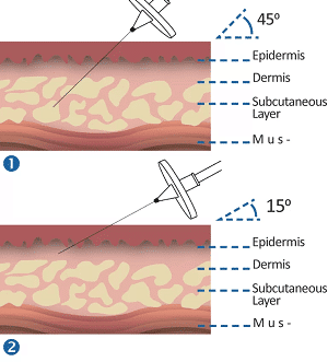 carboxy mechanism2